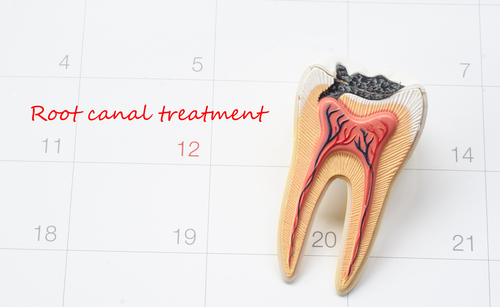 Tips To Care For A Root Canal Tooth