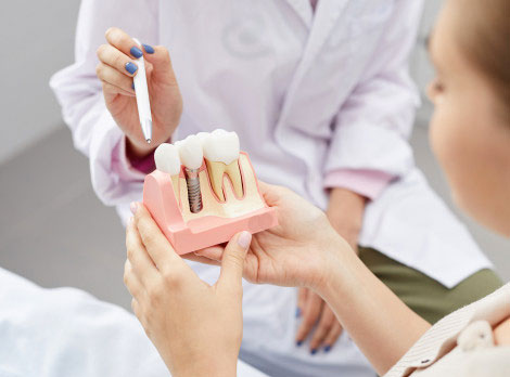 Dental Implans In San Diego Near Mira Mesa
