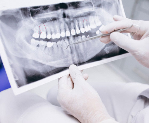 Digital X-Rays In Mira Mesa, San Diego