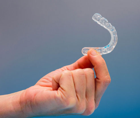 Mouthguards In Mira Mesa