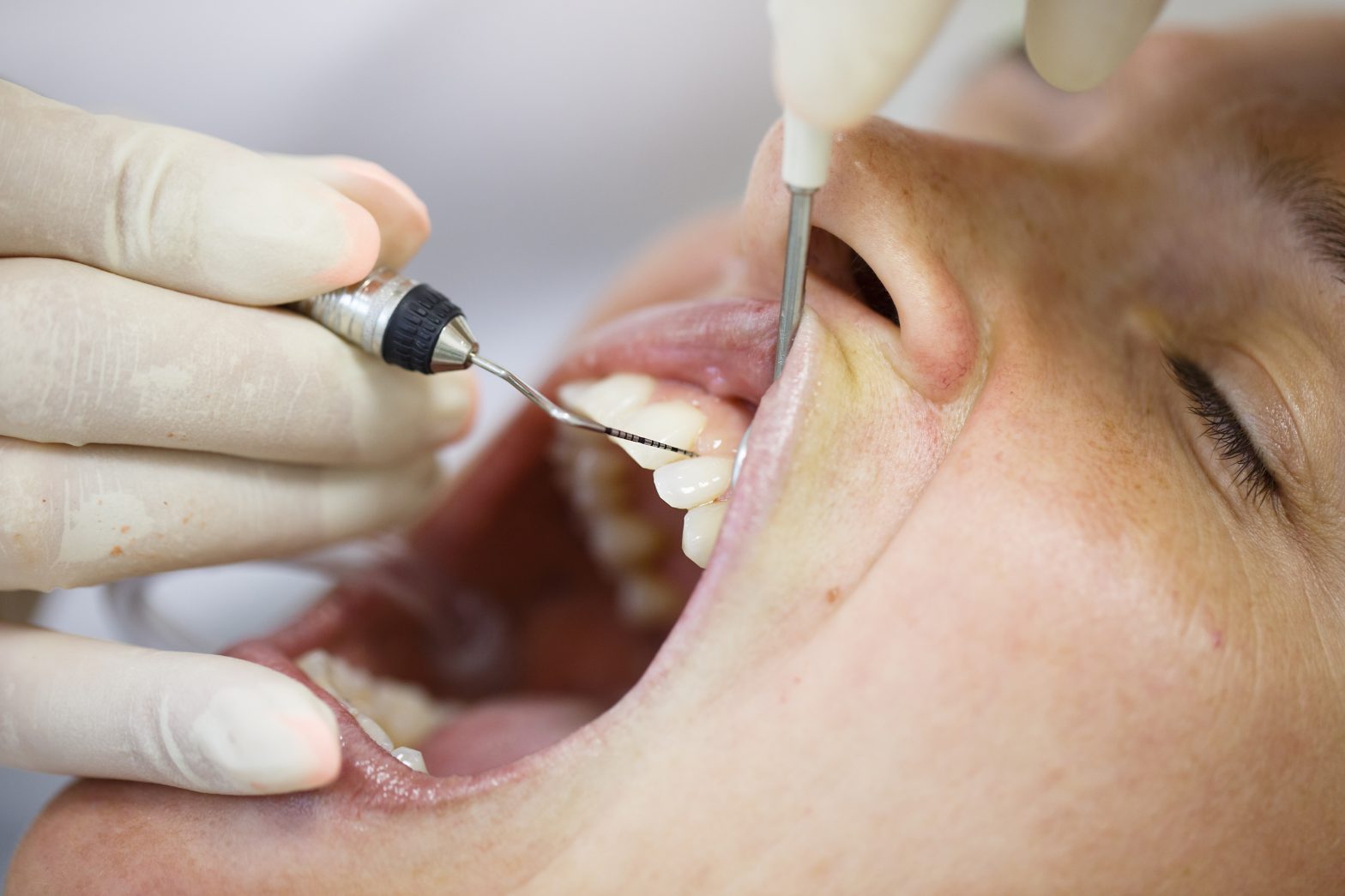 Dentist in Mira Mesa